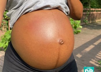 Shocking: “I’ve Never Slept With Anyone, Yet I’m Pregnant” – 27-Year-Old Lady Cries Out